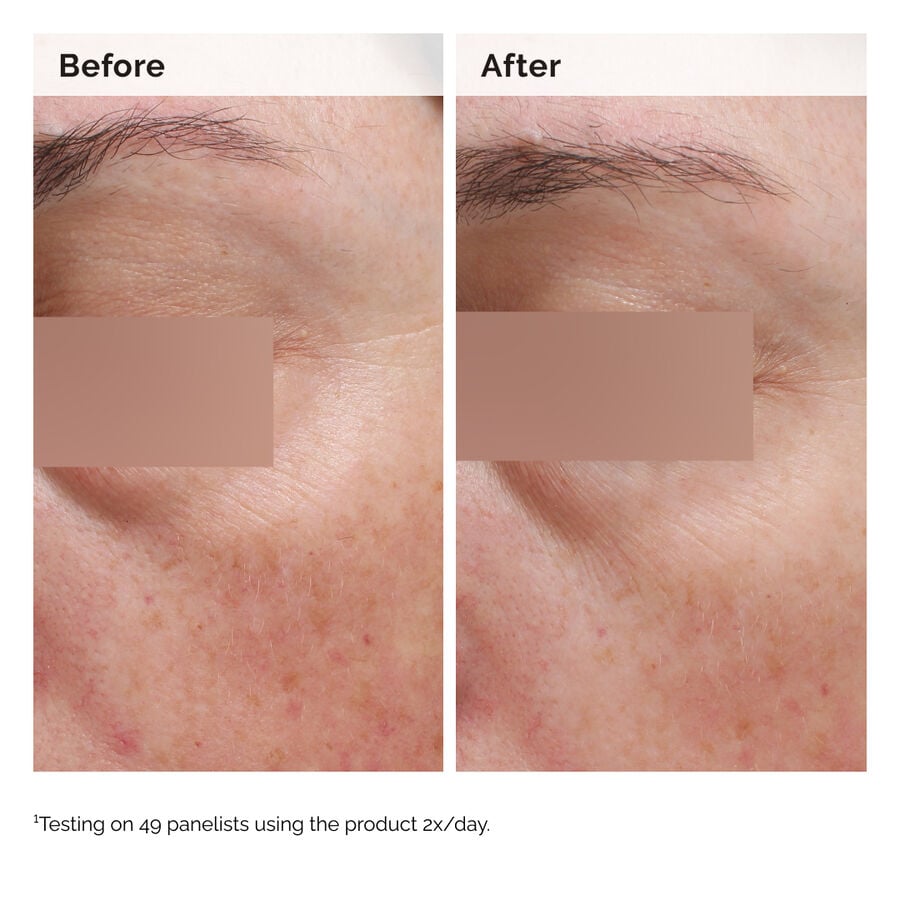 niacinamide-5-face-and-body-emulsion-n9 2024-08-23-ORD-Nia-5pct-Face-Body-B-A-Elasticity-Global-02-1x1.jpg