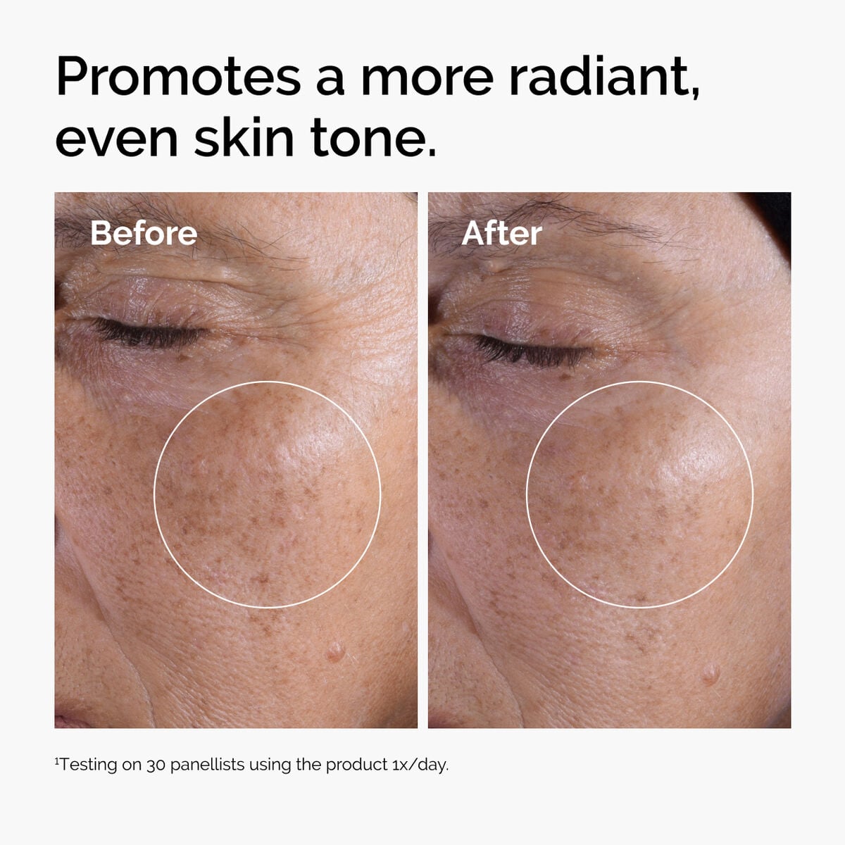 glycolic-acid-7-exfoliating-toner-y1 ord-glycolic-before-after-radiance.jpg