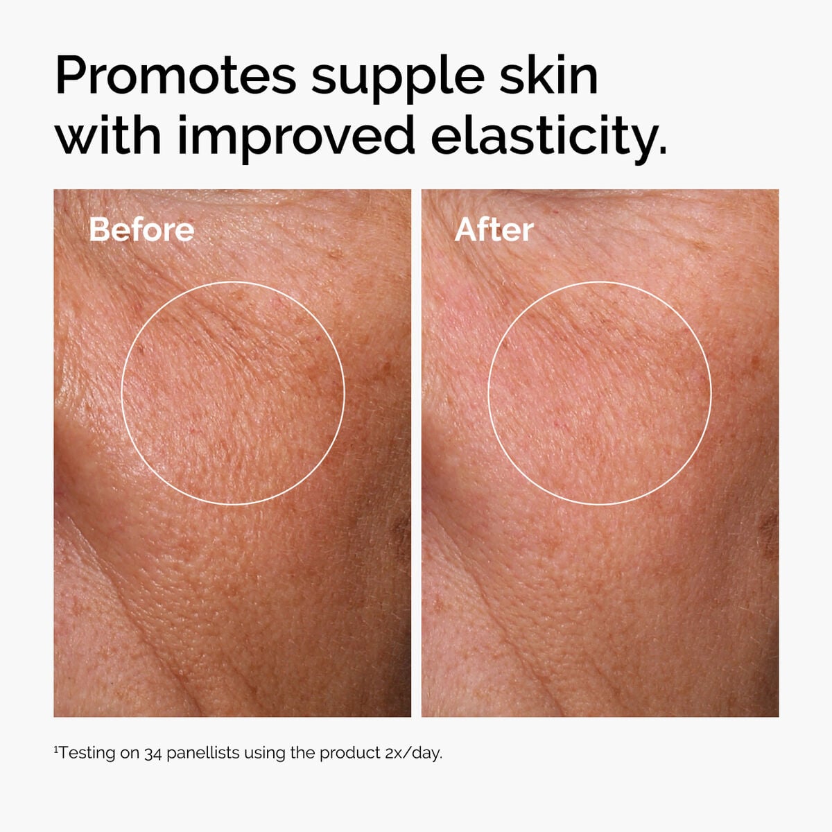 hyaluronic-acid-2-b5-with-ceramides-i6 ord-hyaluronic-acid-2pct-b5-hydrating-serum-before-after-elasticity.jpg