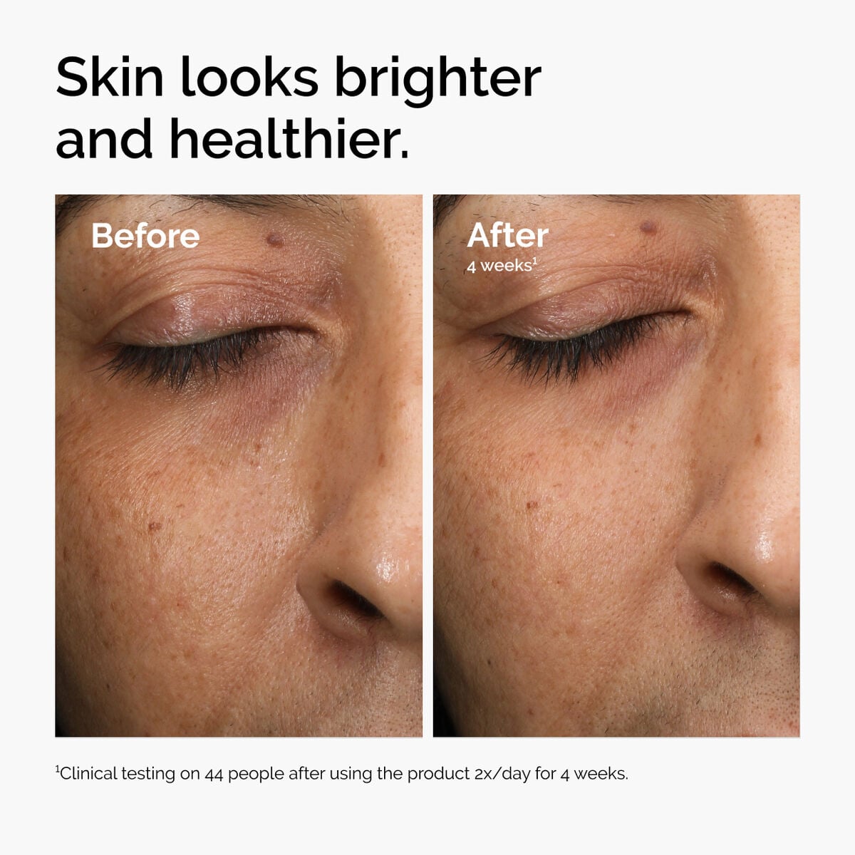 multi-antioxidant-radiance-serum-v8 ord-mars-before-after-healthy.jpg