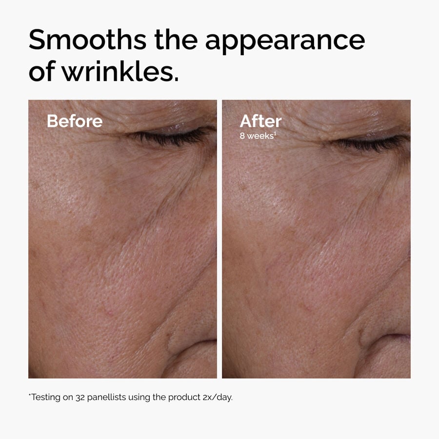 multi-peptide-ha-serum-g3 ord-multi-peptide-ha-serum-wrinkles-before-after.jpg