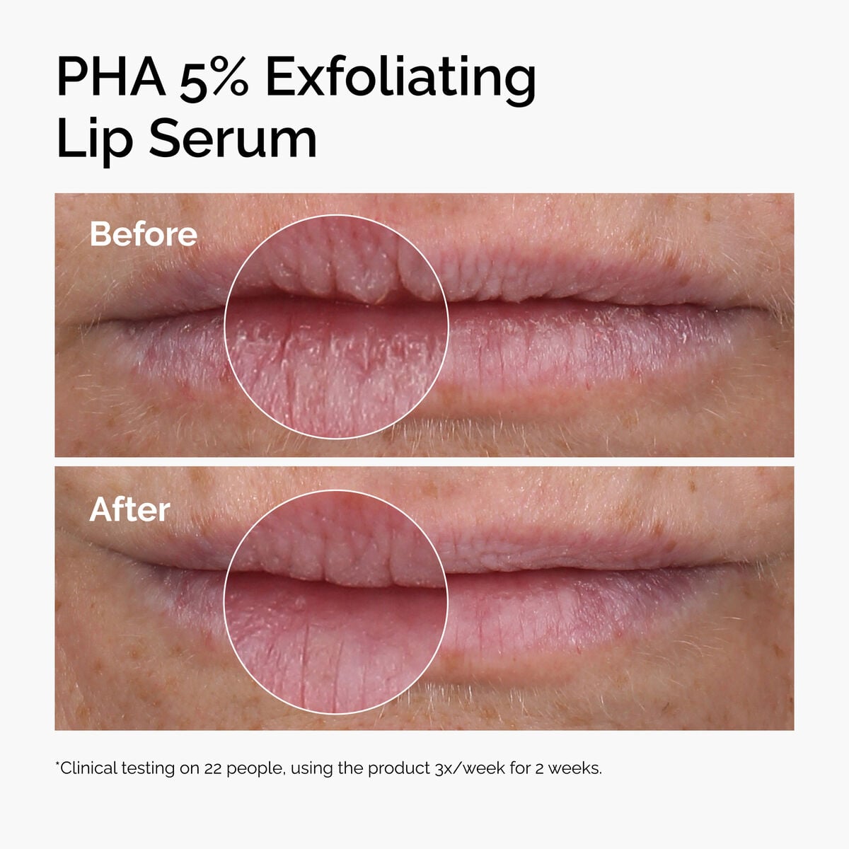 pha-5-exfoliating-lip-serum-v3 ord-pha-5pct-lip-exfoliating-serum-before-after.jpg