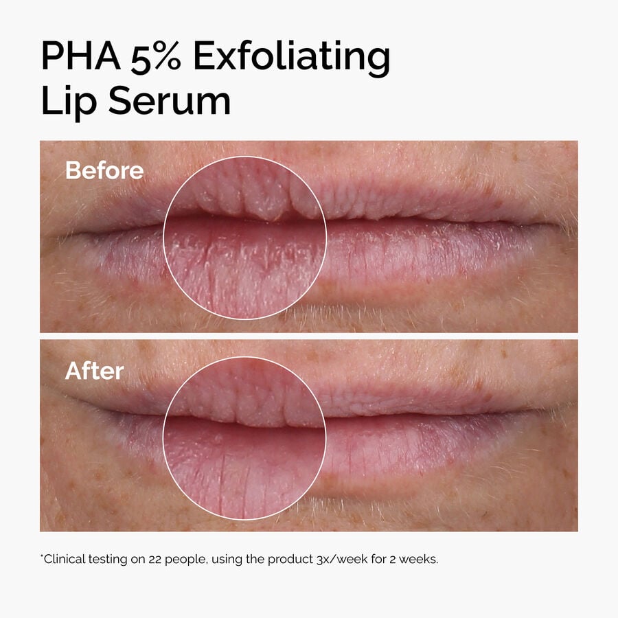 pha-5-exfoliating-lip-serum-v3 ord-pha-5pct-lip-exfoliating-serum-before-after.jpg