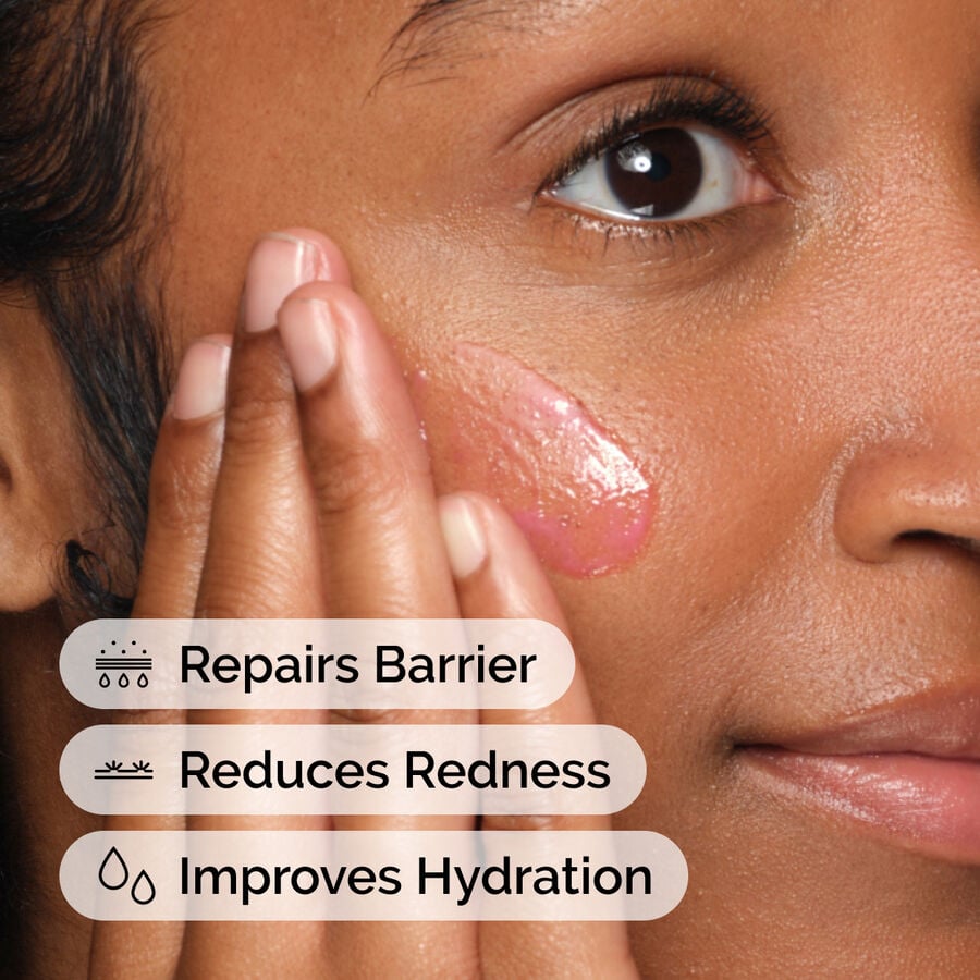 soothing-and-barrier-support-serum-j2 ord-soothing-barrier-support-serum-model-application-with-benefits.jpg